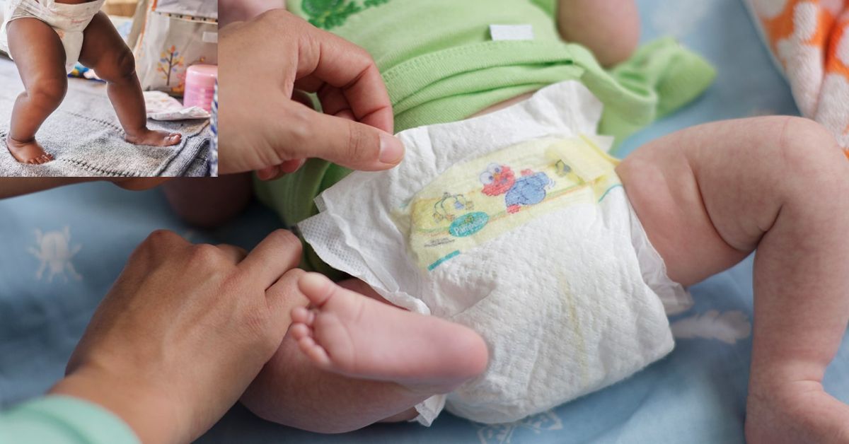 Diapers: పిల్లలకు డైపర్లు వేస్తున్నారా.. ఎన్ని సంవత్సరాల వరకు డైపర్లు వాడవచ్చు.. వైద్యుల సూచన!