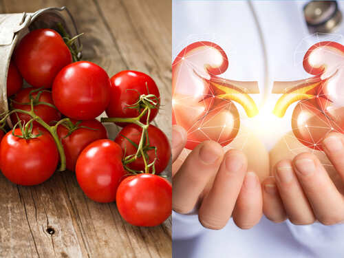 kidney Stones: టమాటాలు తింటే కిడ్నీ రాళ్లు వస్తాయా... తెలిస్తే షాక్ అవుతారు!