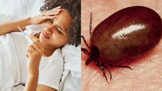 Killer Fever: రైతులు, కార్మికులు హై రిస్క్…! వేగంగా వ్యాపిస్తున్న స్క్రబ్ టైఫస్!