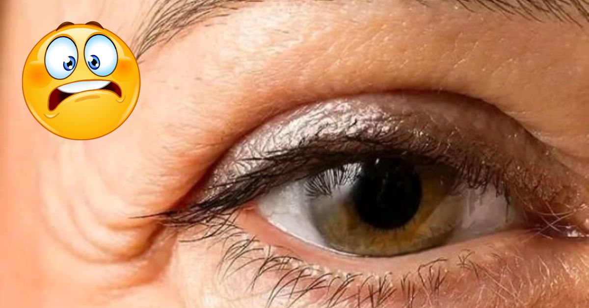 Health Tips: కళ్లే చెబుతున్నాయి కిడ్నీ సమస్యలు.. ఈ లక్షణాలు కనిపిస్తే జాగ్రత్త!