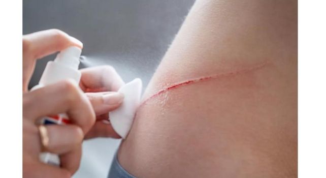 Stop bleeding: క్షణాల్లో రక్తస్రావానికి బ్రేక్… సౌత్ కొరియా సైంటిస్టుల అద్భుత స్ప్రే!