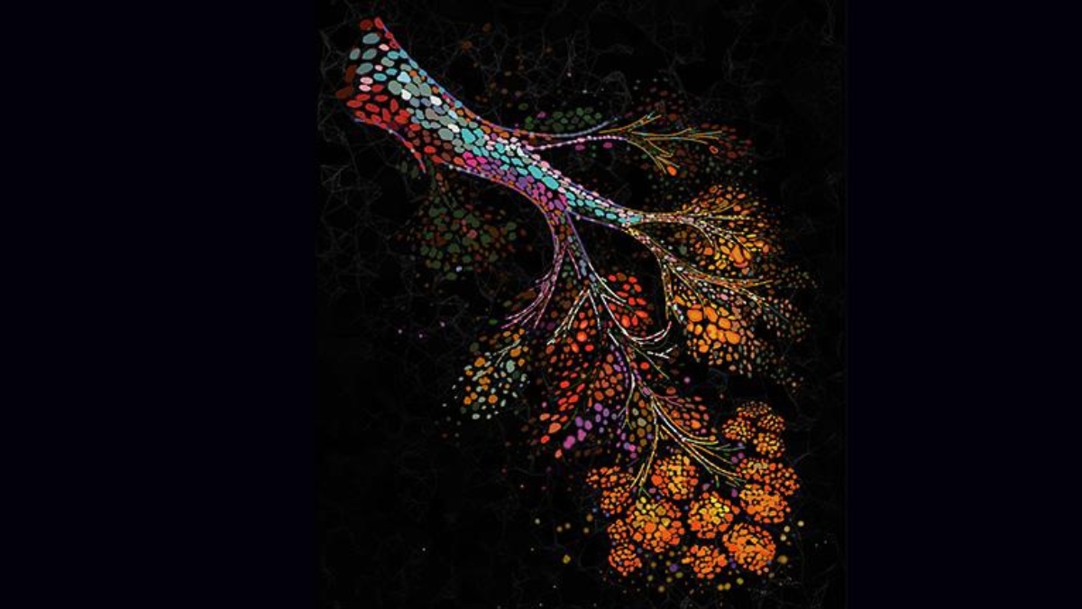 Breast Cancer: వయసు పెరిగే కొద్దీ రొమ్ము క్యాన్సర్ కు కారణం అదేనట... జాగ్రత్త!