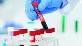 Cancer: ఐదేళ్ల ముందే ఊపిరితిత్తుల క్యాన్సర్‌ను గుర్తించే బ్లడ్ టెస్ట్!