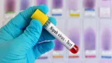 Nipah Virus: నిపా వైరస్ నియంత్రణ చర్యలపై సమీక్ష.. కోజికోడ్‌కు చేరుకున్న NCDC నిపుణుల బృందం!