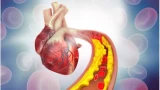 Health story photo