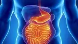Health story photo