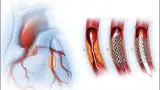 Health story photo